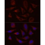 Immunofluorescence - Anti-Stromal interaction molecule 1 Antibody (A87712) - Antibodies.com