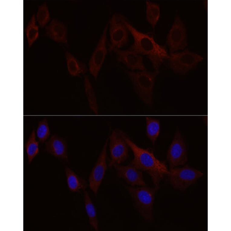 Immunofluorescence - Anti-Stromal interaction molecule 1 Antibody (A87712) - Antibodies.com