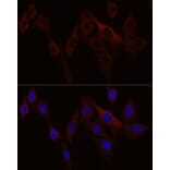 Immunofluorescence - Anti-Stromal interaction molecule 1 Antibody (A87712) - Antibodies.com