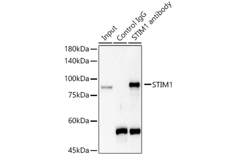 Western Blot - Anti-Stromal interaction molecule 1 Antibody (A87712) - Antibodies.com