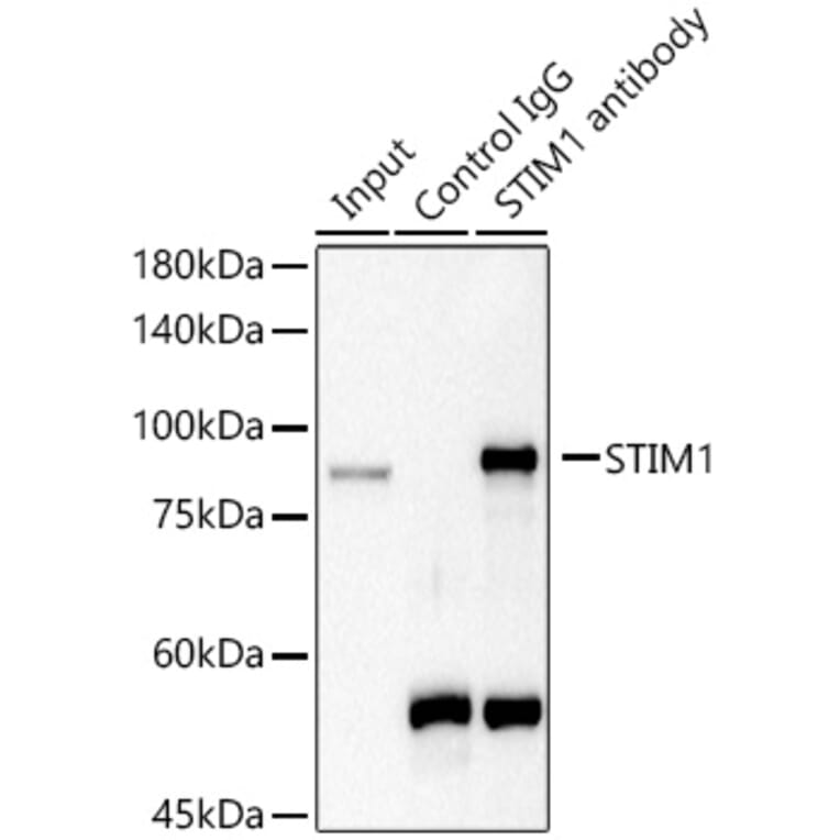 Western Blot - Anti-Stromal interaction molecule 1 Antibody (A87712) - Antibodies.com