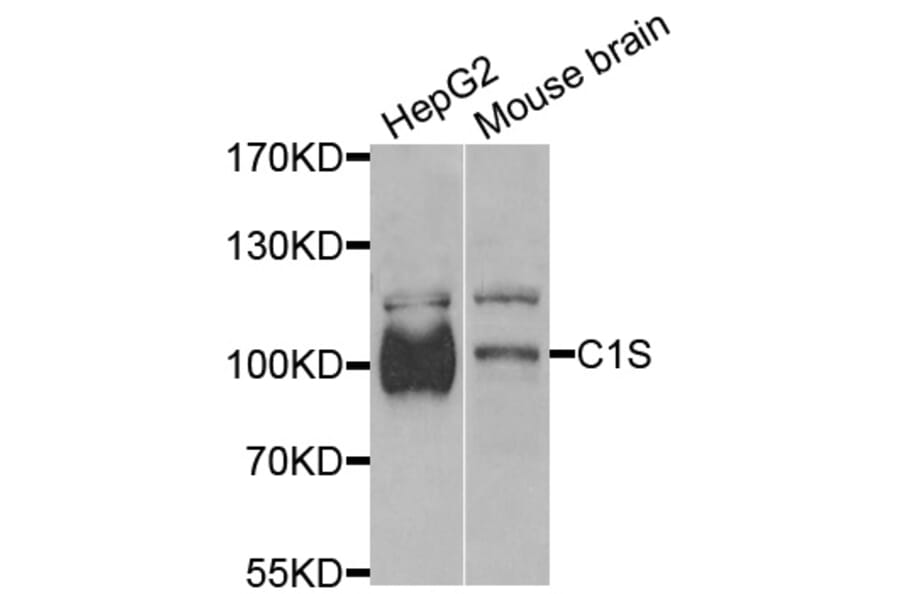Western Blot - Anti-C1S Antibody (A13675) - Antibodies.com
