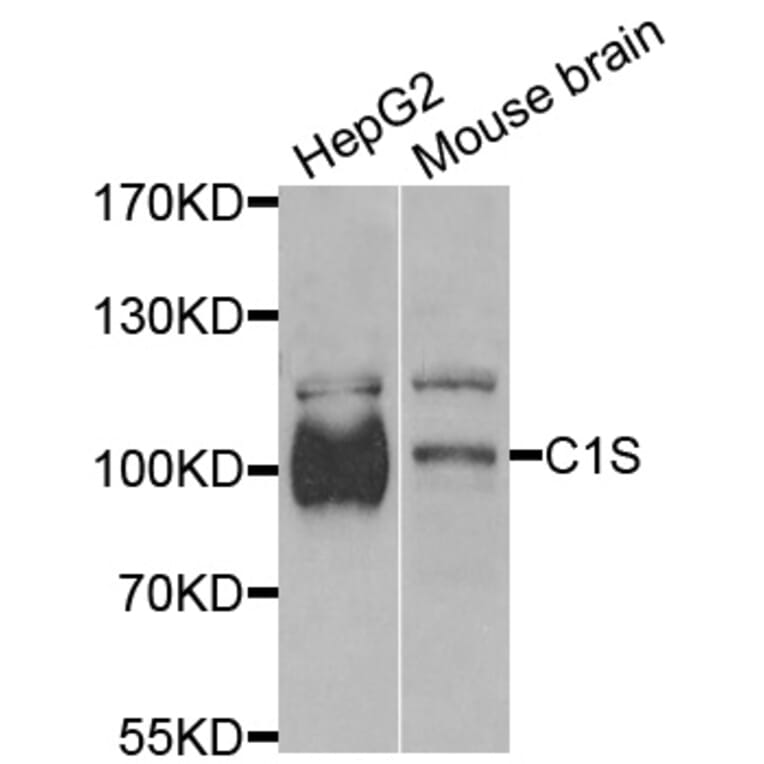 Western Blot - Anti-C1S Antibody (A13675) - Antibodies.com