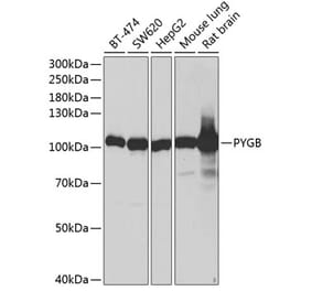 Western Blot - Anti-GPBB Antibody (A87714) - Antibodies.com