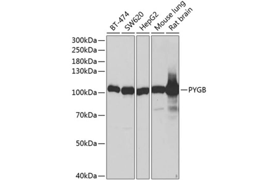 Western Blot - Anti-GPBB Antibody (A87714) - Antibodies.com