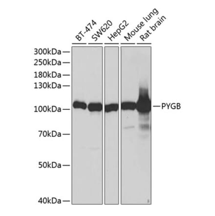 Western Blot - Anti-GPBB Antibody (A87714) - Antibodies.com