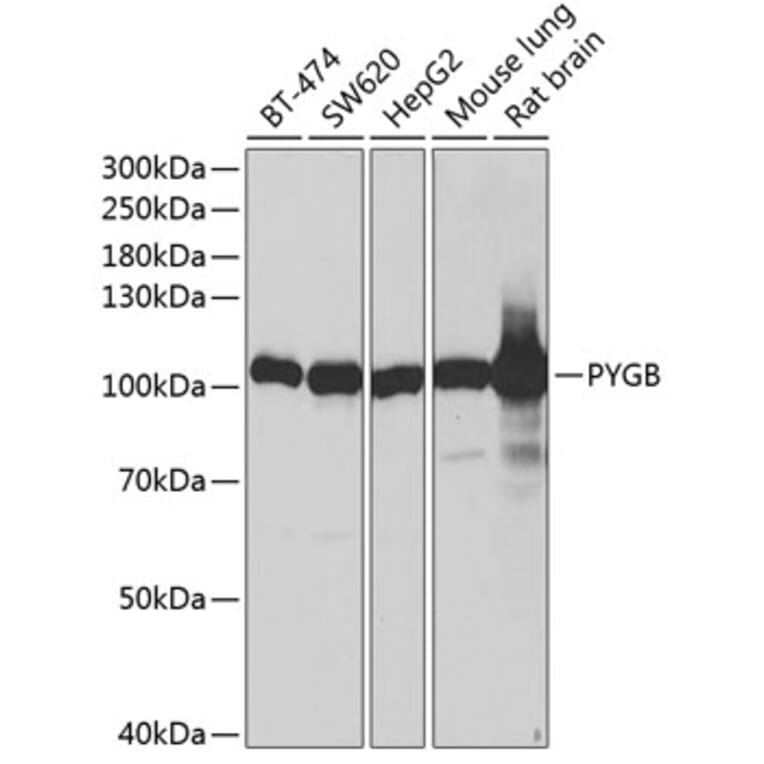 Western Blot - Anti-GPBB Antibody (A87714) - Antibodies.com
