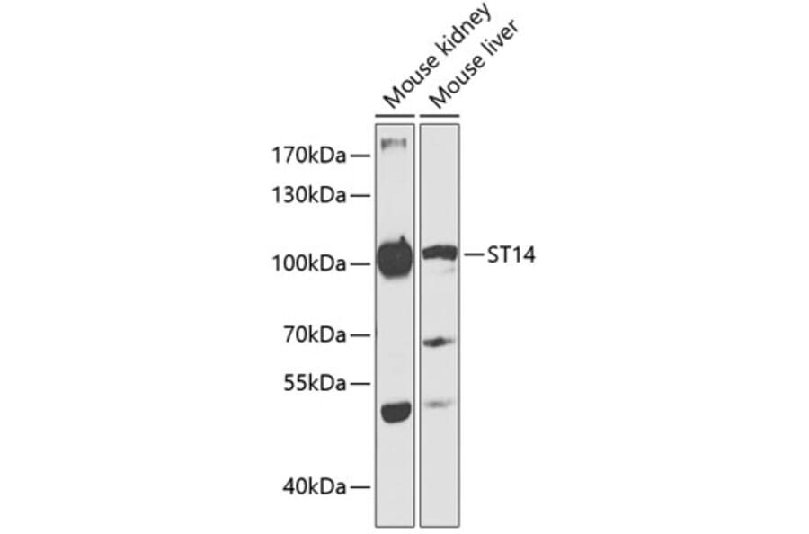 Western Blot - Anti-ST14 Antibody (A87715) - Antibodies.com