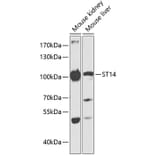 Western Blot - Anti-ST14 Antibody (A87715) - Antibodies.com