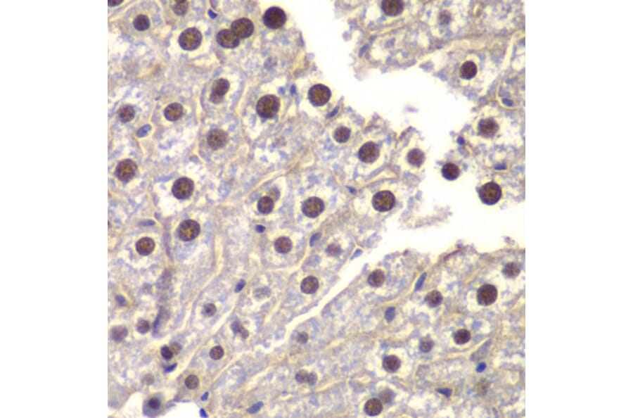 Immunohistochemistry - Anti-ST14 Antibody (A87715) - Antibodies.com