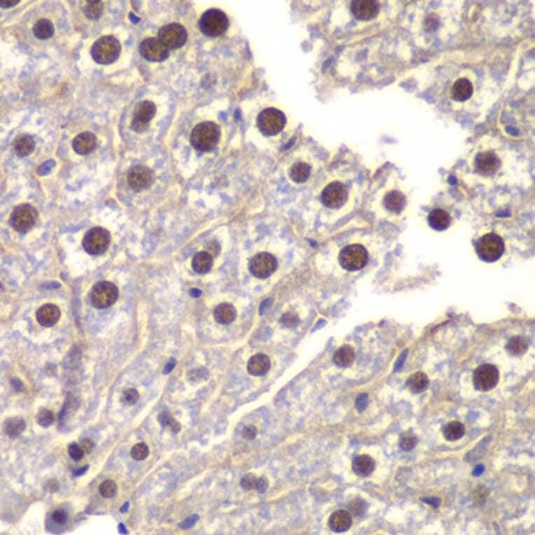 Immunohistochemistry - Anti-ST14 Antibody (A87715) - Antibodies.com
