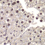 Immunohistochemistry - Anti-ST14 Antibody (A87715) - Antibodies.com