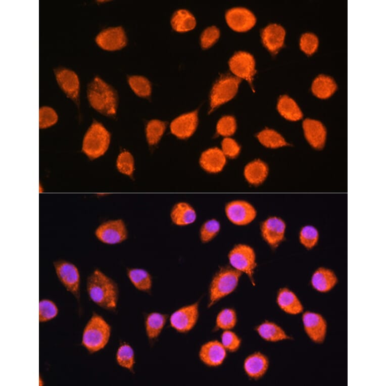 Immunofluorescence - Anti-nSMase-3 Antibody (A87716) - Antibodies.com
