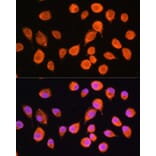Immunofluorescence - Anti-nSMase-3 Antibody (A87716) - Antibodies.com