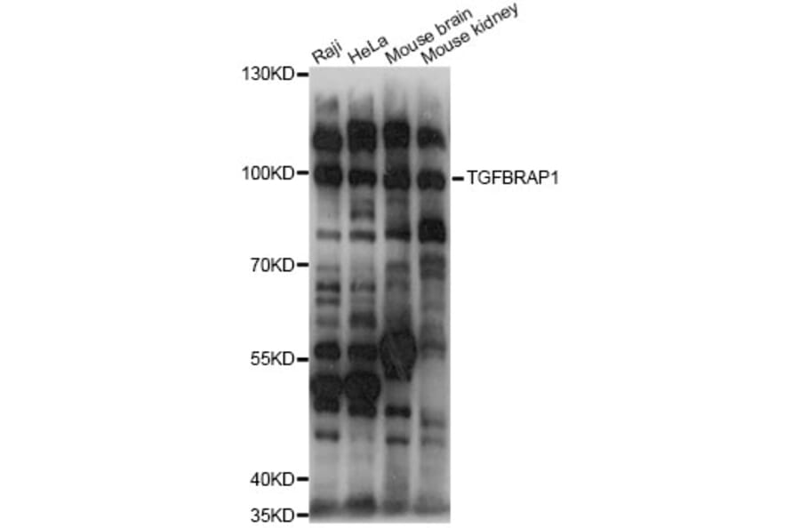 Western Blot - Anti-TGFBRAP1 Antibody (A14386) - Antibodies.com