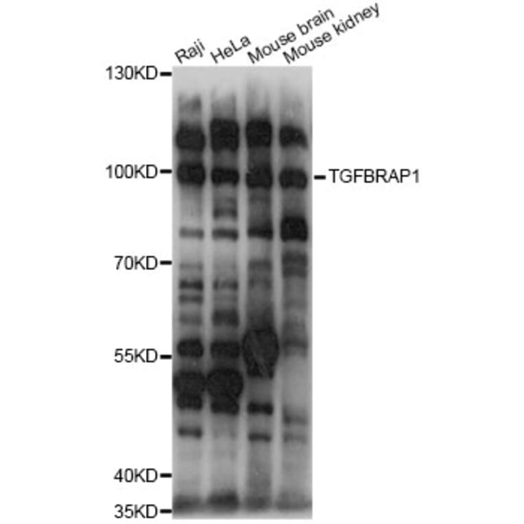 Western Blot - Anti-TGFBRAP1 Antibody (A14386) - Antibodies.com