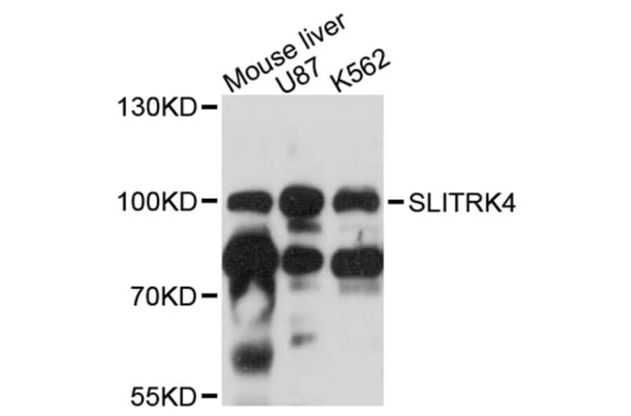 Western Blot - Anti-SLITRK4 Antibody (A12936) - Antibodies.com