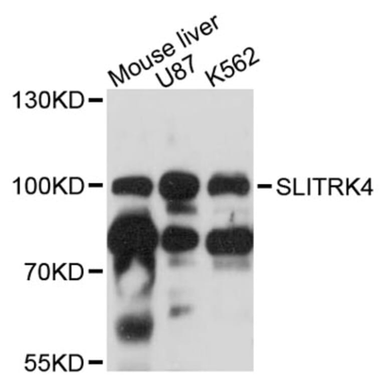 Western Blot - Anti-SLITRK4 Antibody (A12936) - Antibodies.com