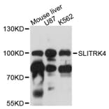 Western Blot - Anti-SLITRK4 Antibody (A12936) - Antibodies.com