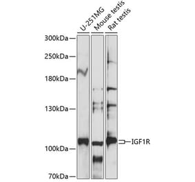 Western Blot - Anti-IGF1 Receptor Antibody (A87722) - Antibodies.com
