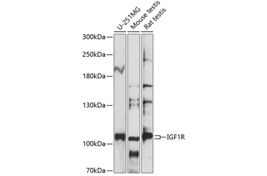 Western Blot - Anti-IGF1 Receptor Antibody (A87722) - Antibodies.com