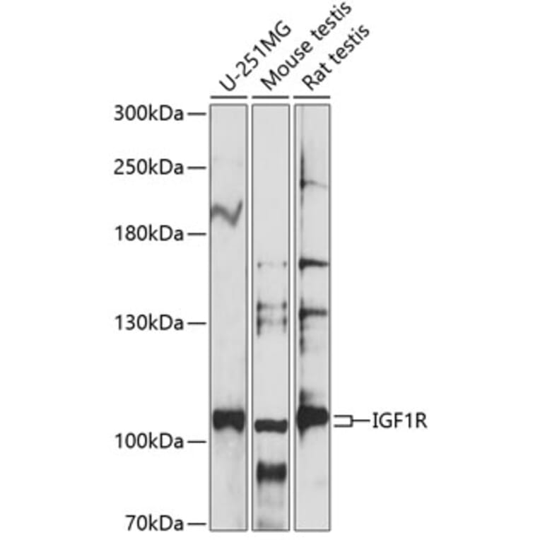 Western Blot - Anti-IGF1 Receptor Antibody (A87722) - Antibodies.com