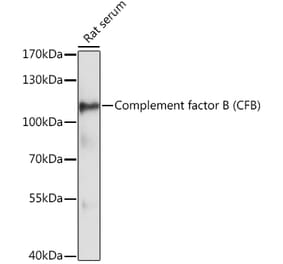 Western Blot - Anti-Complement factor B Antibody (A87723) - Antibodies.com
