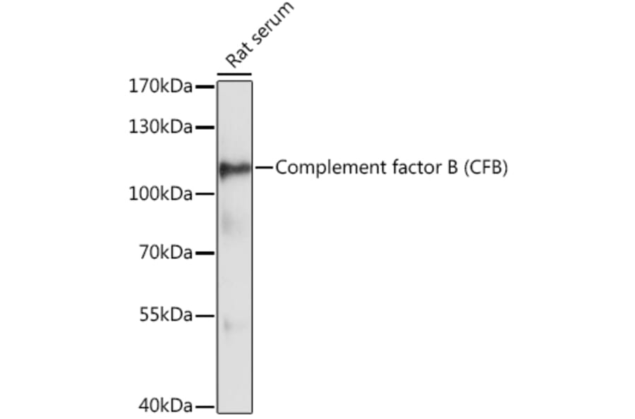 Western Blot - Anti-Complement factor B Antibody (A87723) - Antibodies.com