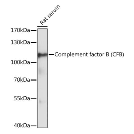 Western Blot - Anti-Complement factor B Antibody (A87723) - Antibodies.com