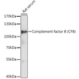 Western Blot - Anti-Complement factor B Antibody (A87723) - Antibodies.com