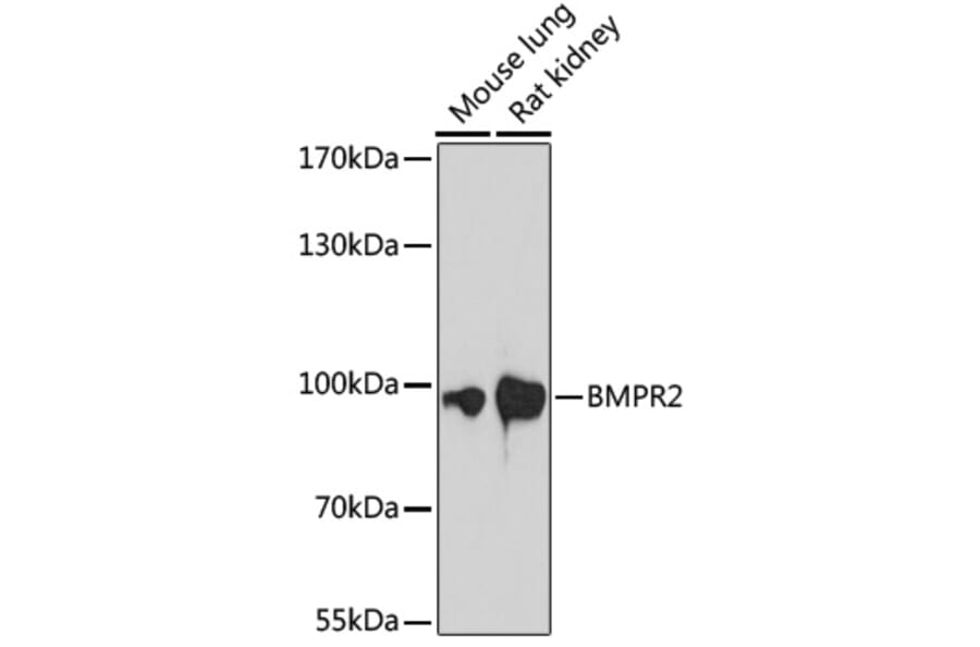Anti-BMPR2 Antibody (A87724) - Western blot