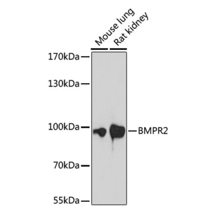 Western Blot - Anti-BMPR2 Antibody (A87724) - Antibodies.com