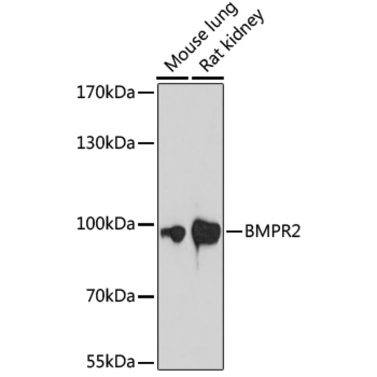 Western Blot - Anti-BMPR2 Antibody (A87724) - Antibodies.com