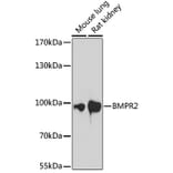 Western Blot - Anti-BMPR2 Antibody (A87724) - Antibodies.com