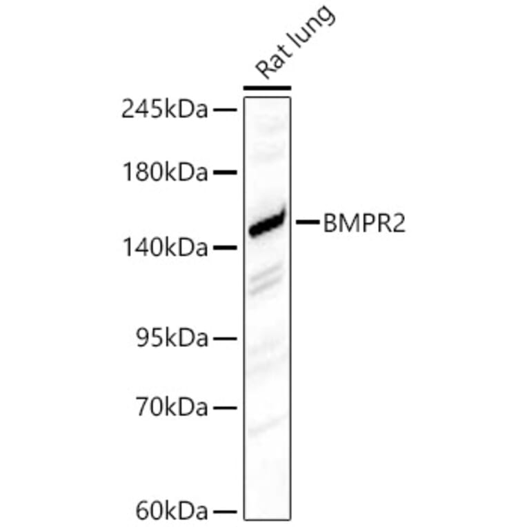Western Blot - Anti-BMPR2 Antibody (A87724) - Antibodies.com