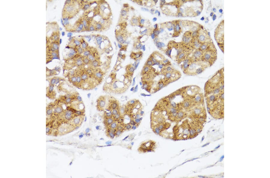 Immunohistochemistry - Anti-BMPR2 Antibody (A87724) - Antibodies.com