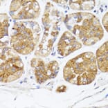 Immunohistochemistry - Anti-BMPR2 Antibody (A87724) - Antibodies.com