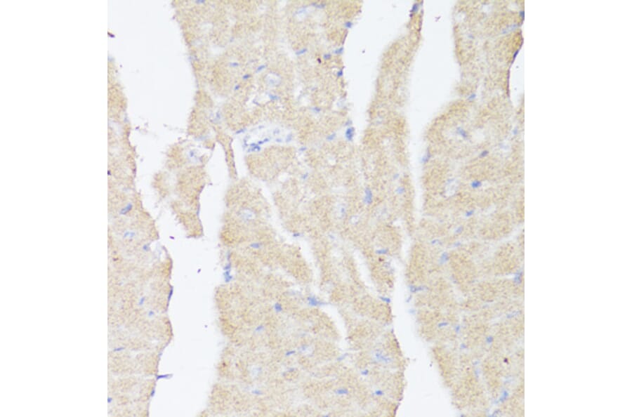 Immunohistochemistry - Anti-BMPR2 Antibody (A87724) - Antibodies.com
