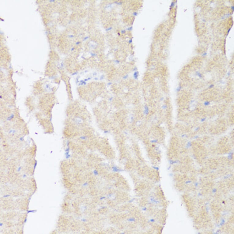 Immunohistochemistry - Anti-BMPR2 Antibody (A87724) - Antibodies.com
