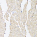 Immunohistochemistry - Anti-BMPR2 Antibody (A87724) - Antibodies.com