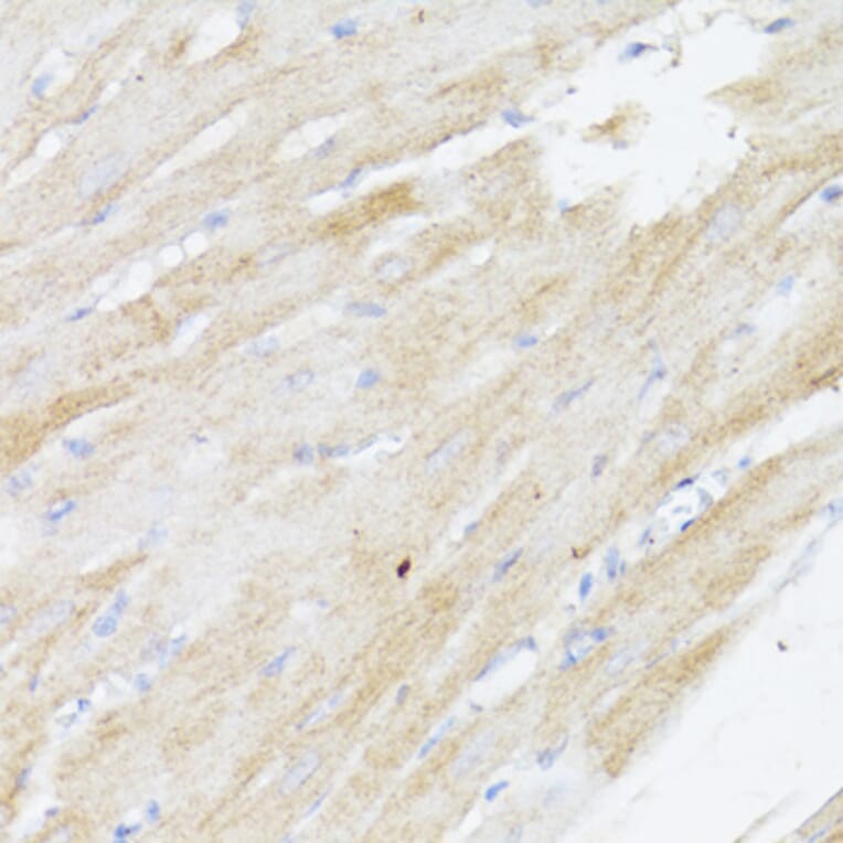 Immunohistochemistry - Anti-BMPR2 Antibody (A87724) - Antibodies.com