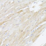 Immunohistochemistry - Anti-BMPR2 Antibody (A87724) - Antibodies.com