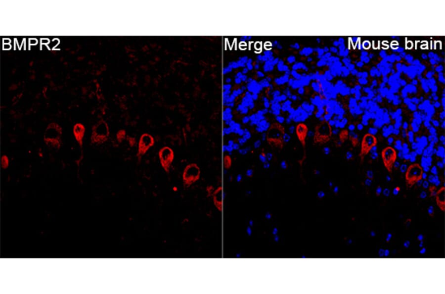 Immunofluorescence - Anti-BMPR2 Antibody (A87724) - Antibodies.com