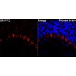 Immunofluorescence - Anti-BMPR2 Antibody (A87724) - Antibodies.com