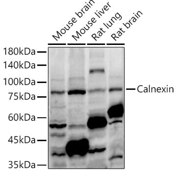 Anti-Calnexin Antibody (A87725) | Antibodies.com