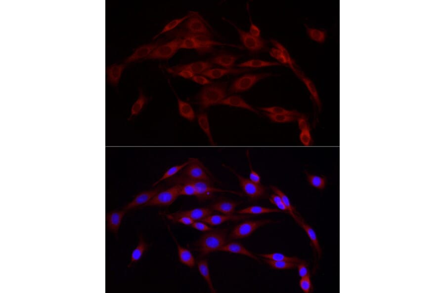 Immunofluorescence - Anti-Calnexin Antibody (A87725) - Antibodies.com