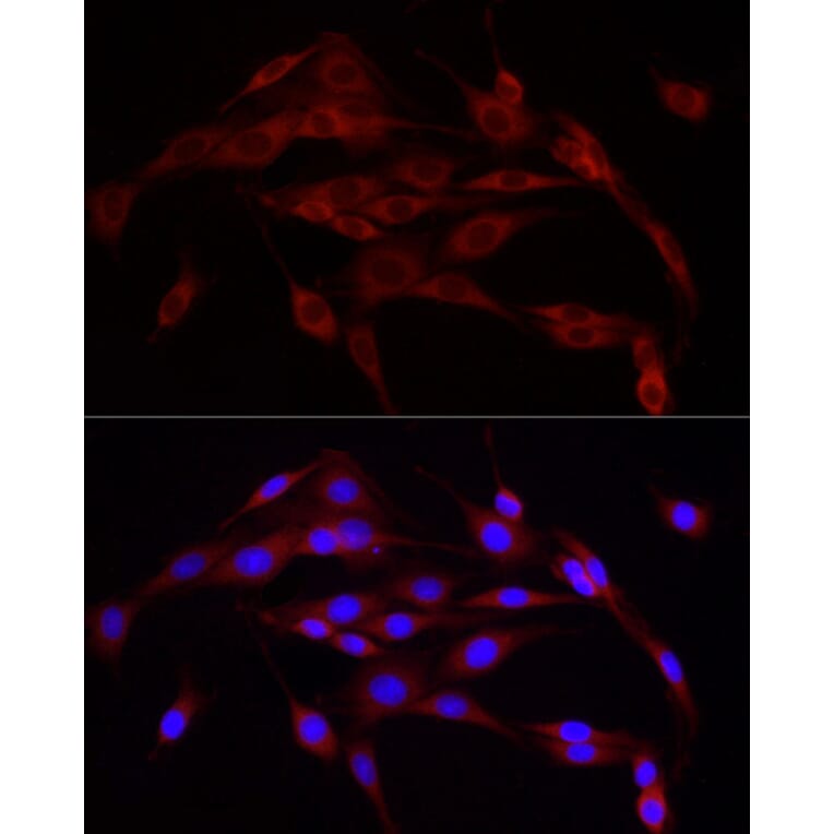 Immunofluorescence - Anti-Calnexin Antibody (A87725) - Antibodies.com