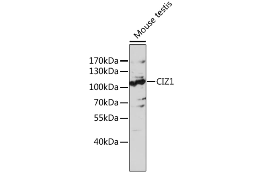 Western Blot - Anti-CDKN1A interacting zinc finger protein 1/CIZ1 Antibody (A87726) - Antibodies.com
