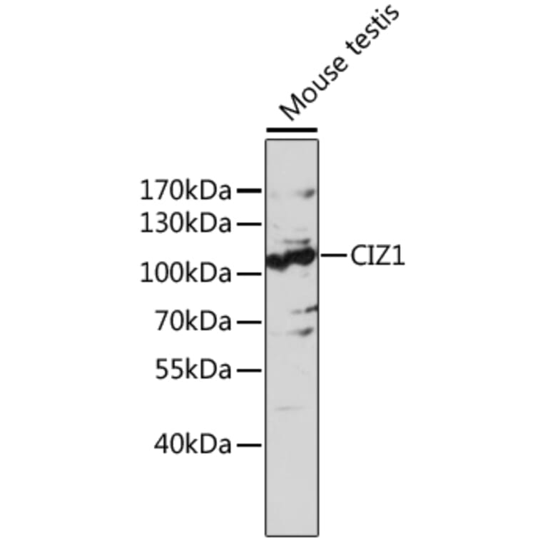 Western Blot - Anti-CDKN1A interacting zinc finger protein 1/CIZ1 Antibody (A87726) - Antibodies.com