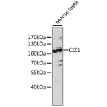 Western Blot - Anti-CDKN1A interacting zinc finger protein 1/CIZ1 Antibody (A87726) - Antibodies.com